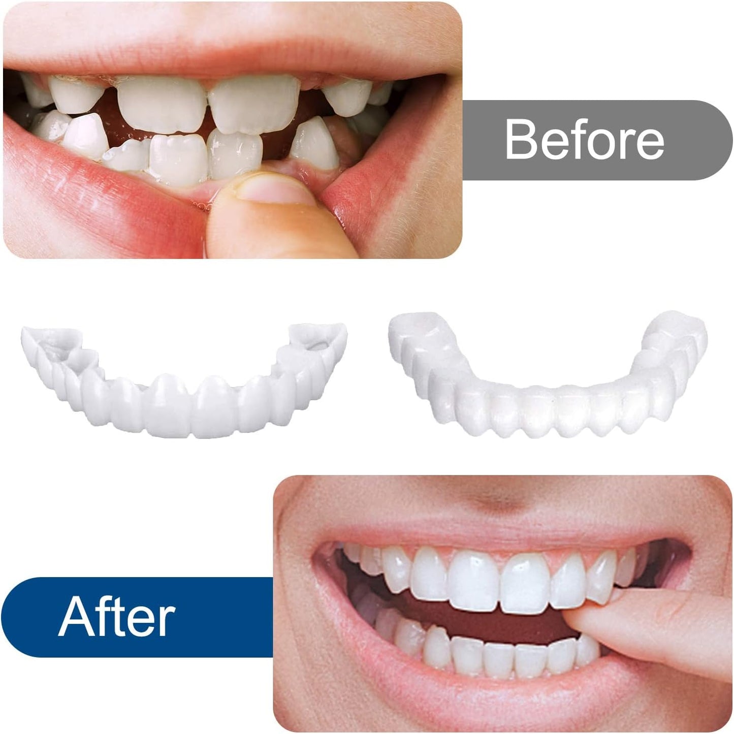 Snap in Teeth for Men and Women