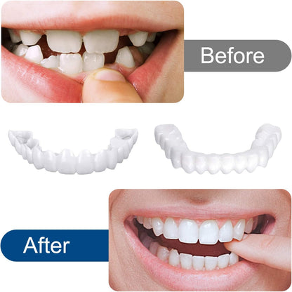 Snap in Teeth for Men and Women